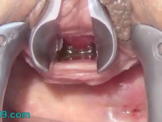Onanere med en tandbørste og en kæde i urinrøret